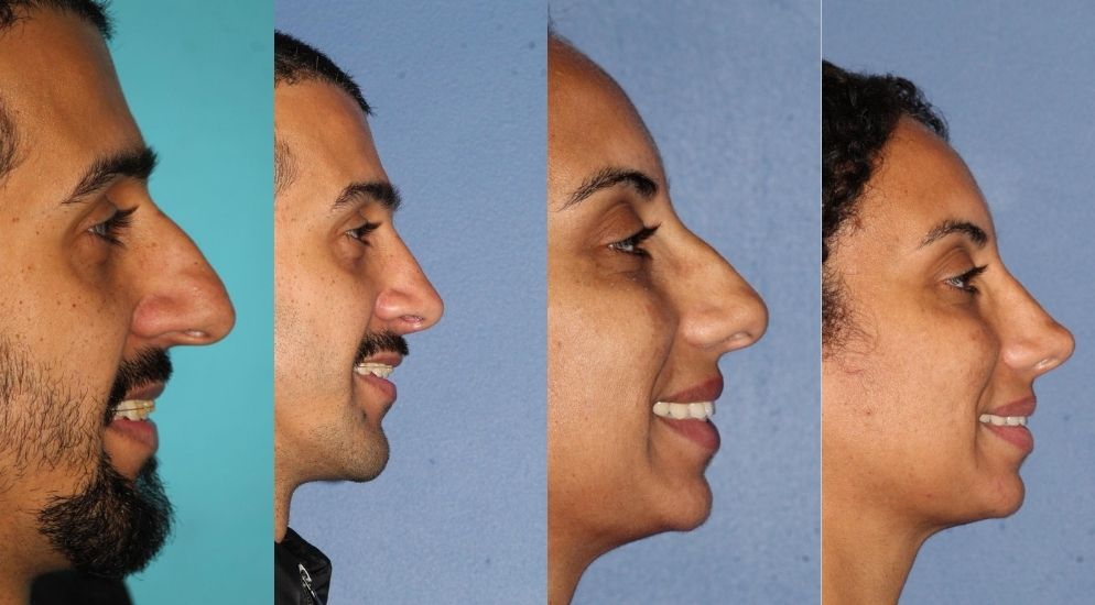 Resultado 2